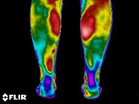 Lincs Thermal Imaging Evaluation Service
